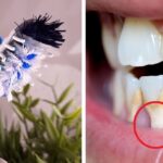 Tres indicios de que cepillas los dientes con mucha fuerza y destruyes el tejido de las encías