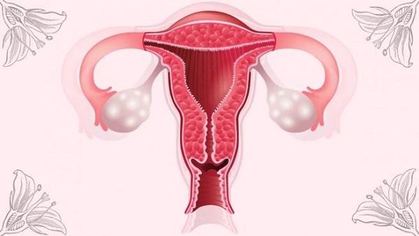 Cáncer de Ovarios: Asesino silencioso que aumenta el riesgo de padecerlo a partir de los 50 años